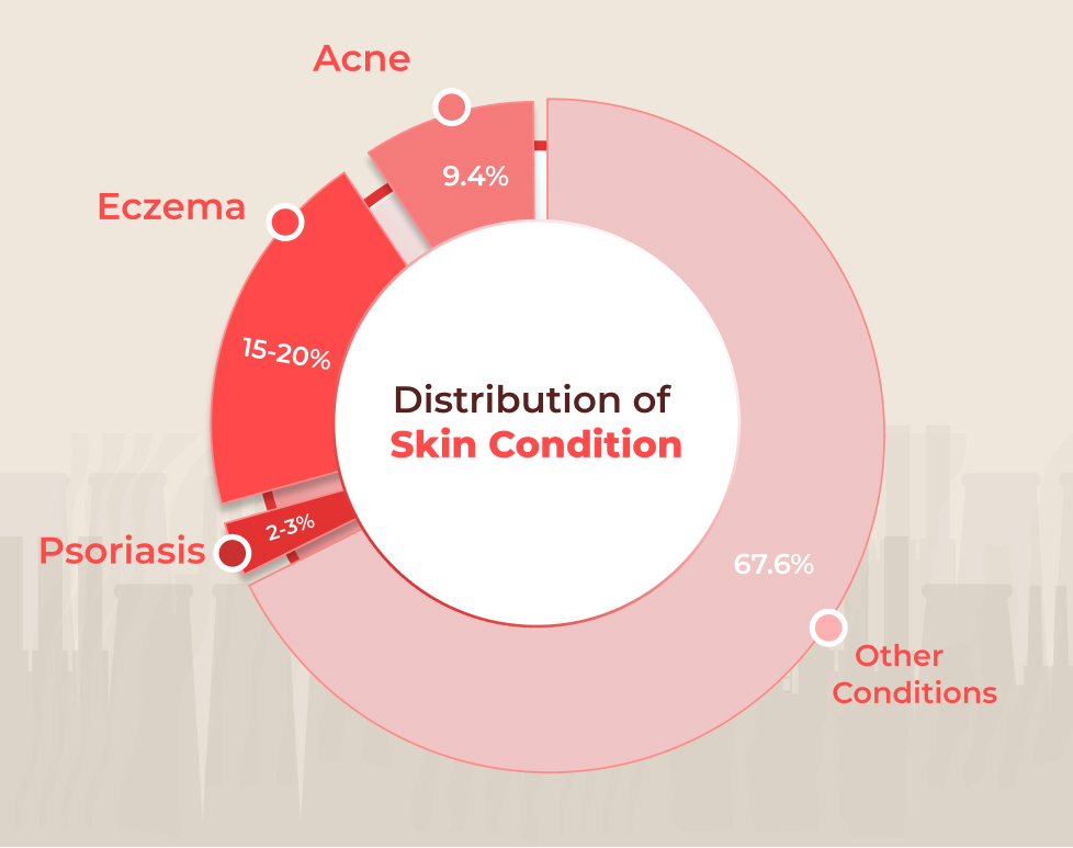 Acne, eczema e psoríase estão entre as condições de pele junto com outros problemas.